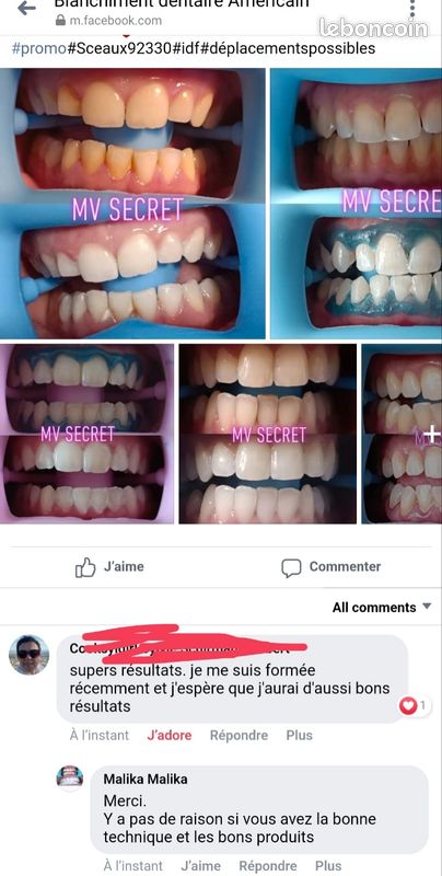 Formation en Blanchiment Dentaire: Illuminez Votre Sourire!